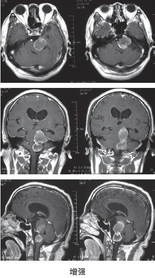 外院MRI