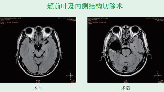 QQ截圖20161205162917.jpg