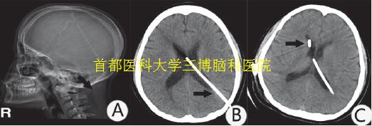 資料