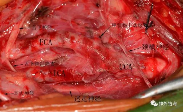 三博腦科屆頸動(dòng)脈內(nèi)膜剝脫術(shù)學(xué)習(xí)班邀請(qǐng)函