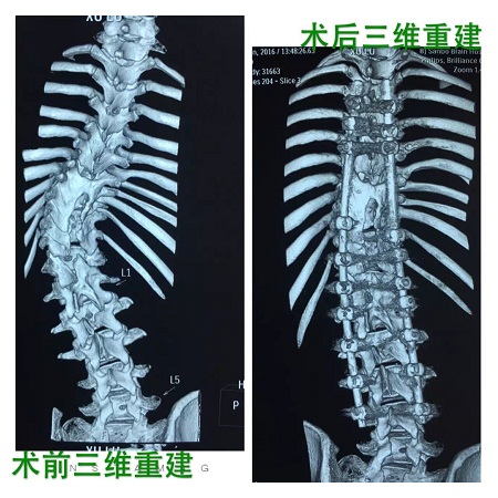 三博脊髓脊柱診療中心作為“中國夢·脊梁工程 特約合作醫(yī)院”