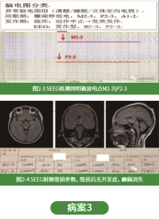 微信截圖_20201123085732.png