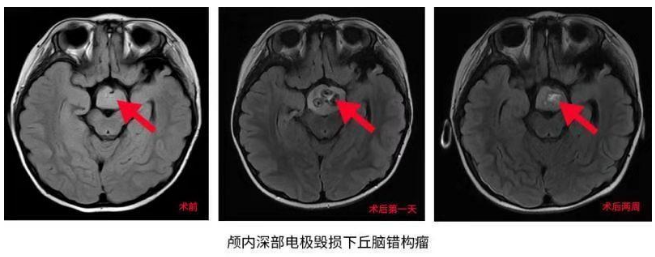 3歲女童愛笑性格好？她的“微笑”卻讓父母操碎了心