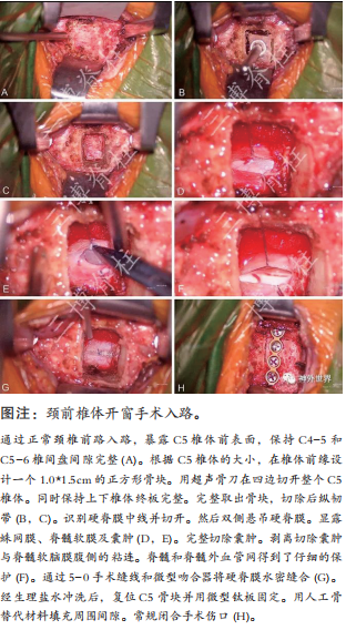 專訪范濤教授 - 唇亡齒寒： 脊髓脊柱外科的前世、今生與未來