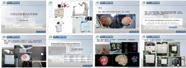 任杰：神經(jīng)外科手術(shù)機(jī)器人PK框架手術(shù)